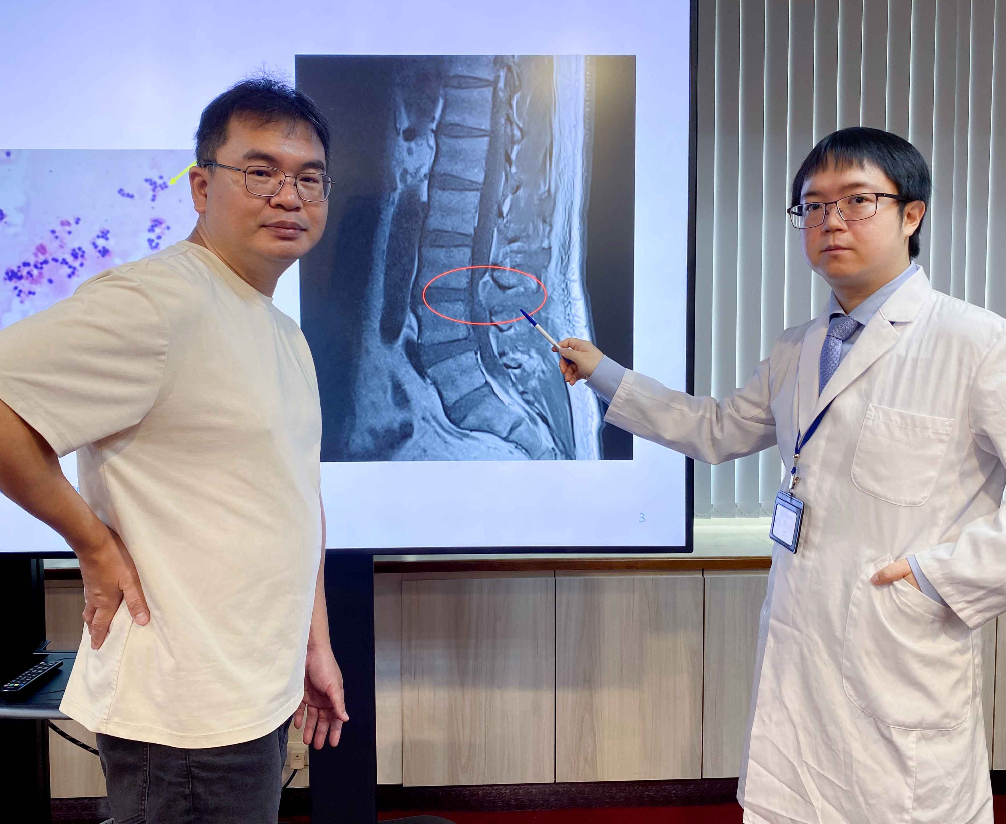 台中》久燒腰痛竟是細菌侵心脊！中榮採「OPAT」治療 48歲男免長期住院重獲新生