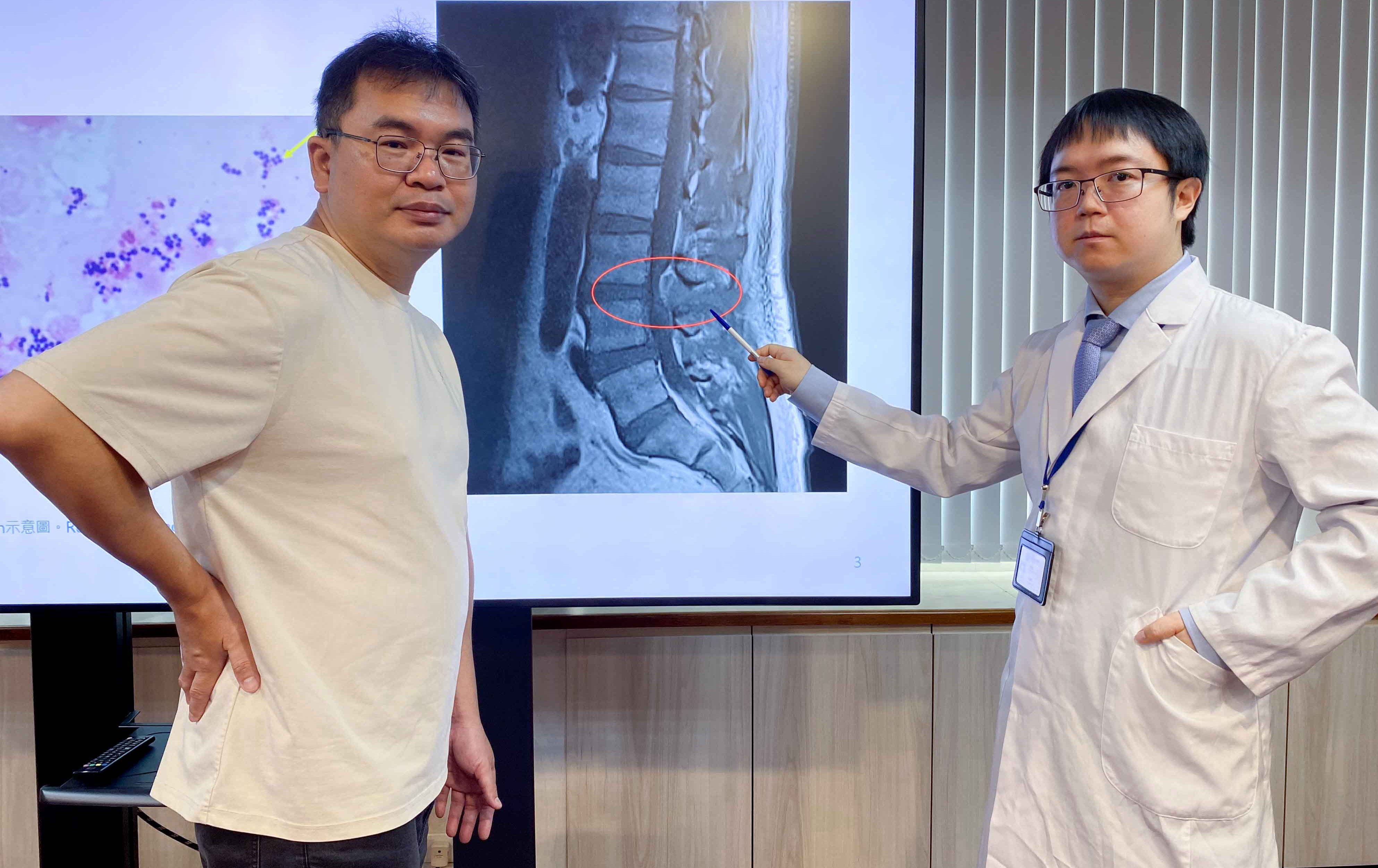 台中》久燒腰痛竟是細菌侵心脊！中榮採「OPAT」治療 48歲男免長期住院重獲新生