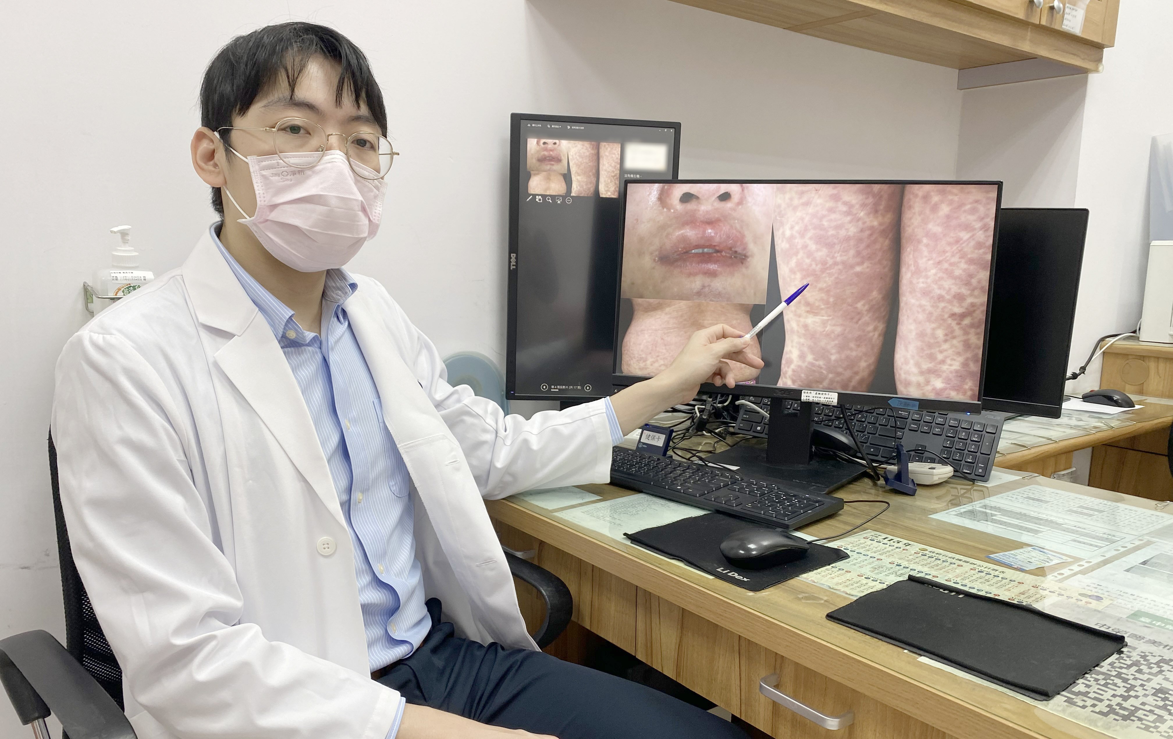 台中》嚴重藥物過敏恐致命 臺中榮總透過免疫與基因檢測揪出致敏成分