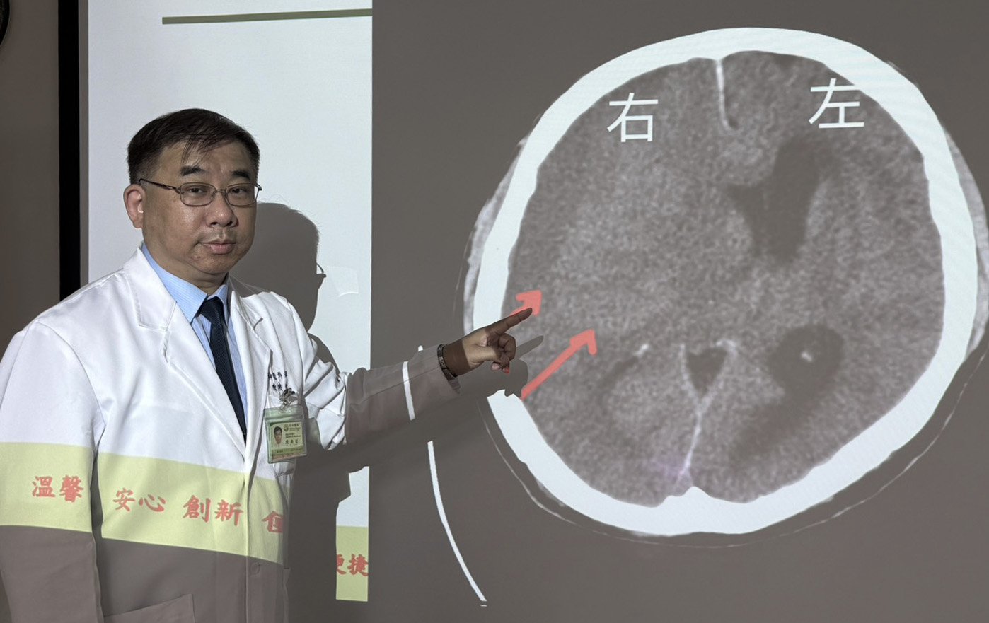 台中》端午節前勞累驚覺單側無力 攤商「亞急性腦出血」醫籲三徵兆速就醫