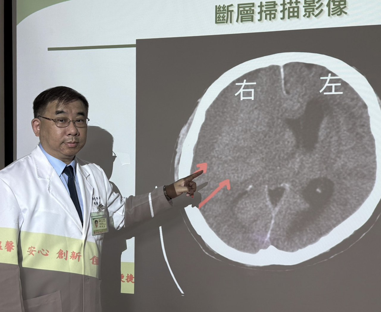 台中》端午節前勞累驚覺單側無力 攤商「亞急性腦出血」醫籲三徵兆速就醫